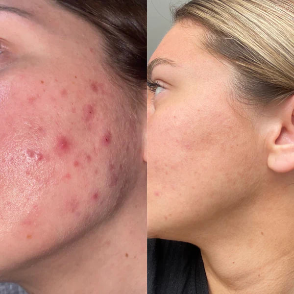 GenLora LED GlowBrush